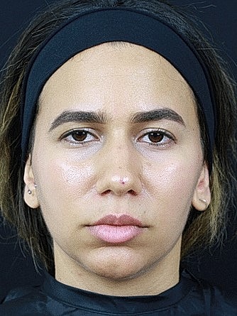 Woman with a neutral expression and headband.