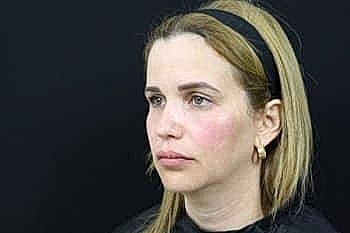 Woman with light makeup against a dark background.