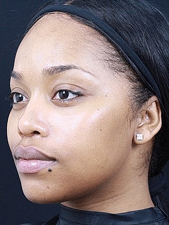 Woman with natural makeup and clear skin.