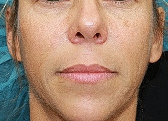 Close-up of a woman’s face, neutral expression.