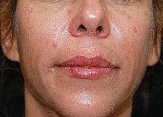 Close-up of woman's face with minimal makeup.