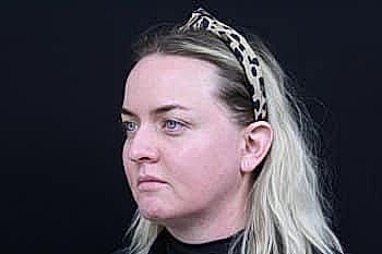 Woman with leopard print headband on black background.