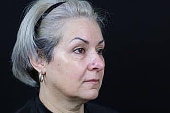 Profile of an older woman with gray hair.