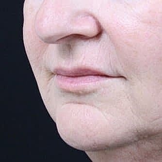 Close-up of a woman's lips and chin.