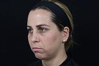 Woman with neutral expression against dark background.