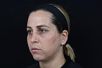 Woman with serious expression against dark background.