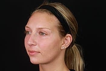 Profile of a young woman with a headband.