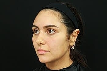 Profile of a young woman against dark background.