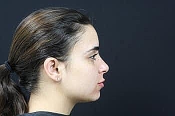 Profile of a woman against a dark background.