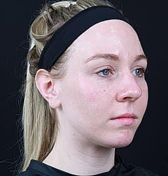 Young woman with long blonde hair, side profile.