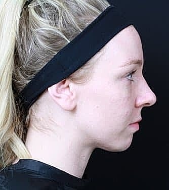 Profile of a person with a headband.