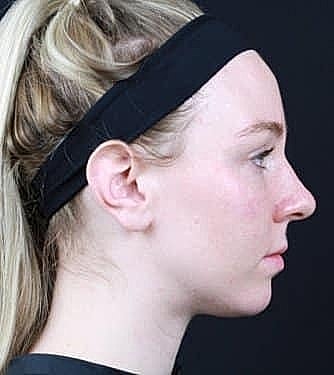 Profile of a woman with a headband.