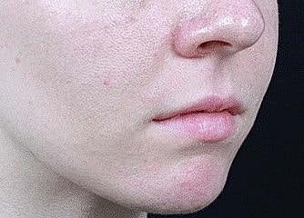 Close-up of a person's lower face.