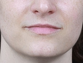 Close-up of lips and chin area.