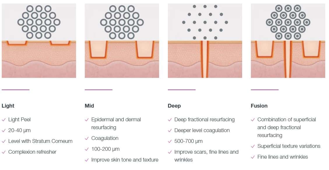 CO2RE laser treatment options