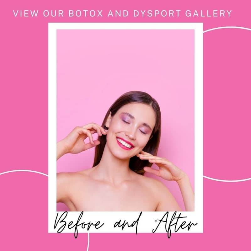 botox gallery