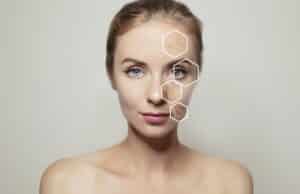 botox treatment areas