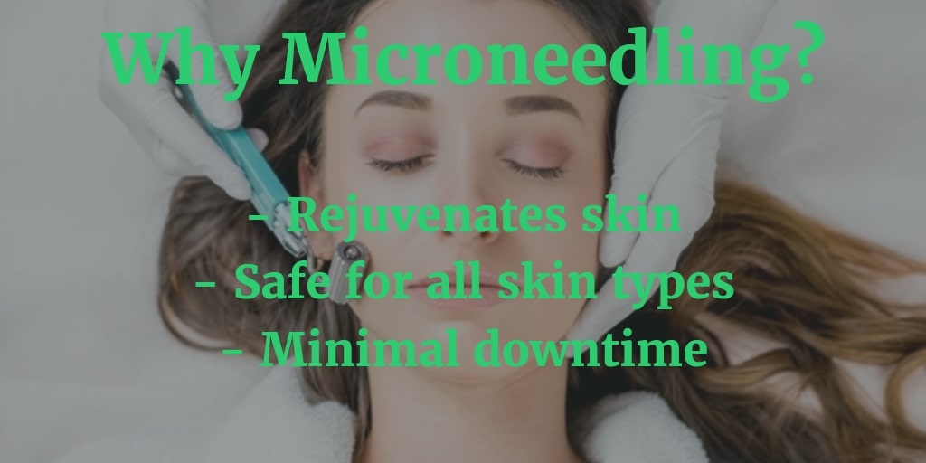 why microneedling