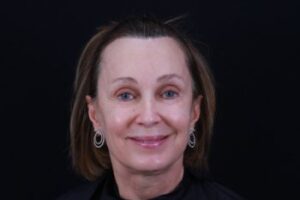 Skin Rejuvenation