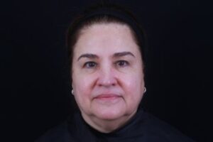 Skin Rejuvenation