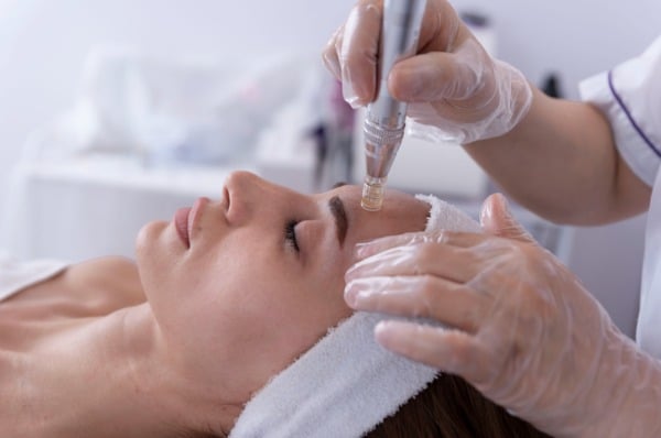 Patients can undergo microneedling treatments at Miami Skin & Vein, Coral Gables, FL.
