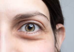 A close-up shot of a woman with bags under her eyes